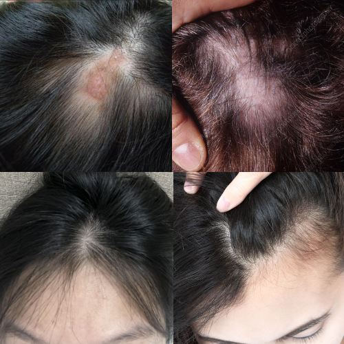 ABRB Hair