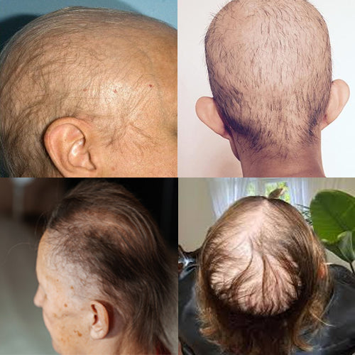 ABRB Hair
