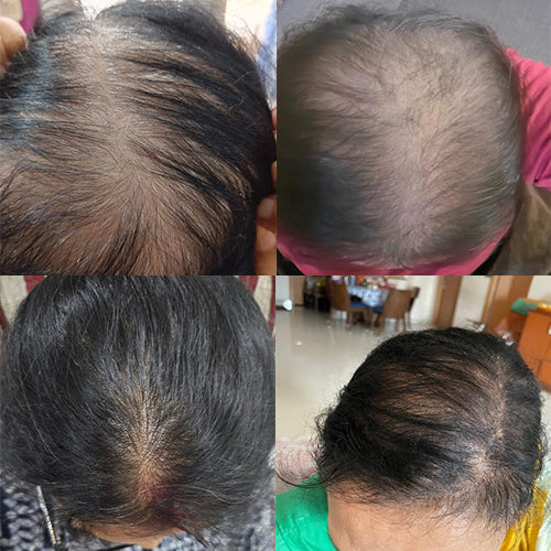ABRB Hair