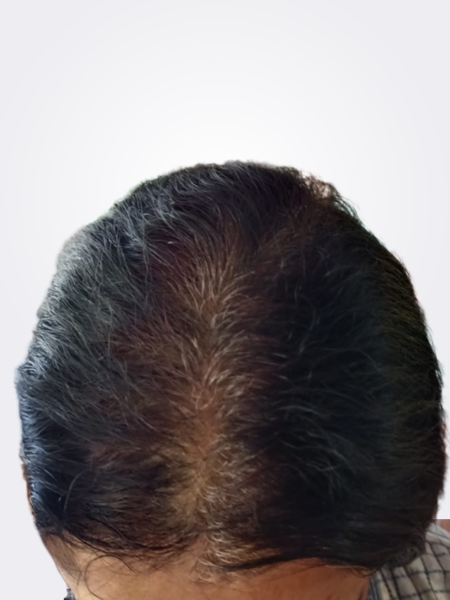 Root Touchup / Grey Hair